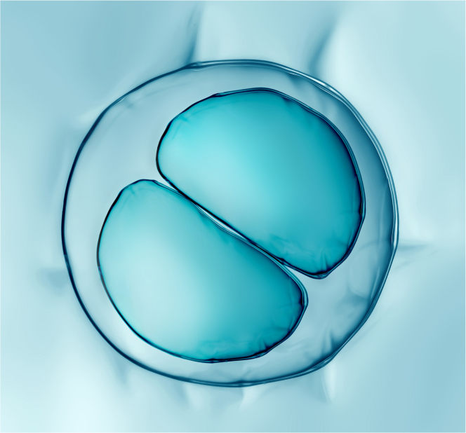 surgery_image