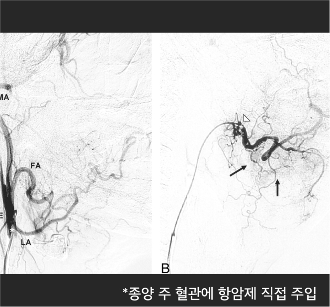 surgery_image