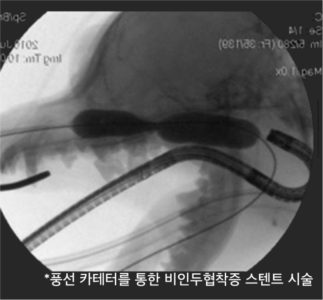 surgery_image