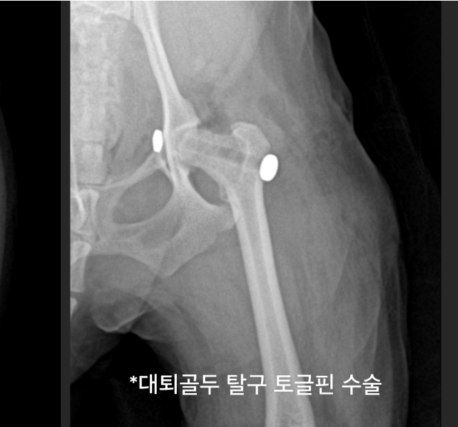surgery_image