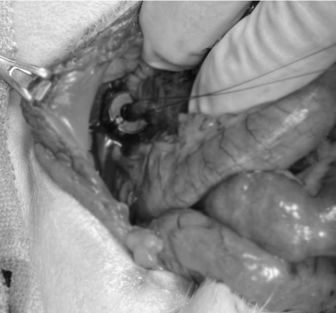 surgery_image